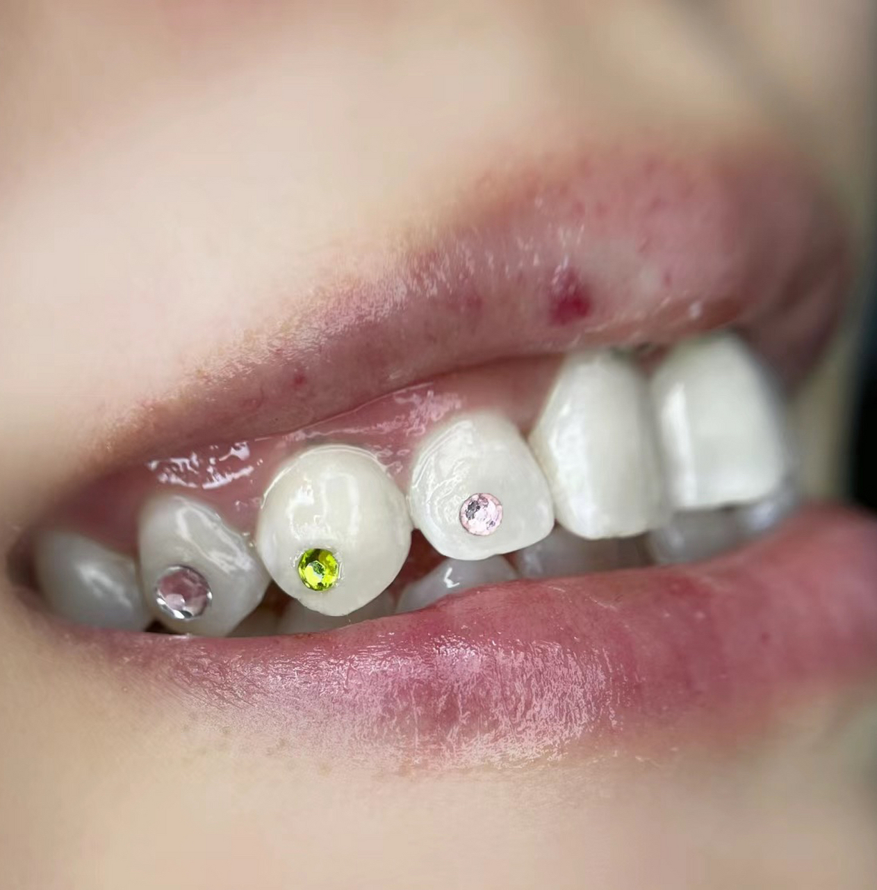 贴牙钻好看吗? 什么玩意儿啊?不理解