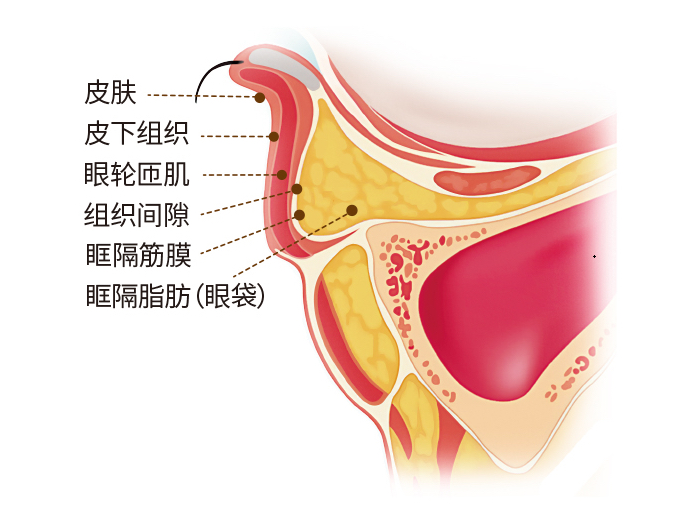"水"就会往眼袋结构眼眶脂肪眼袋内部结构眼袋结构图眼袋解剖结构眶周