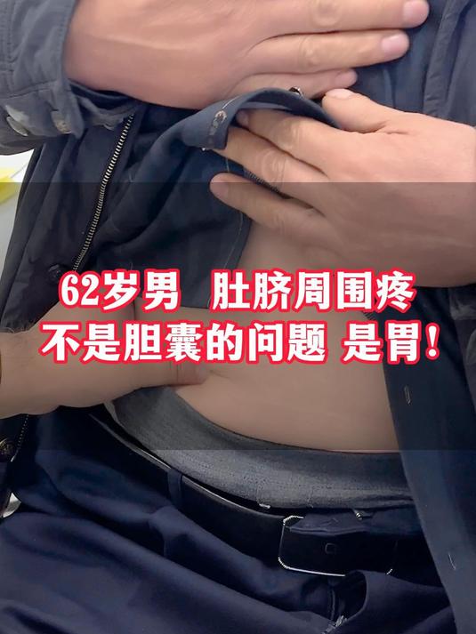 62岁男 肚脐周围疼不是胆囊的问题,是胃!