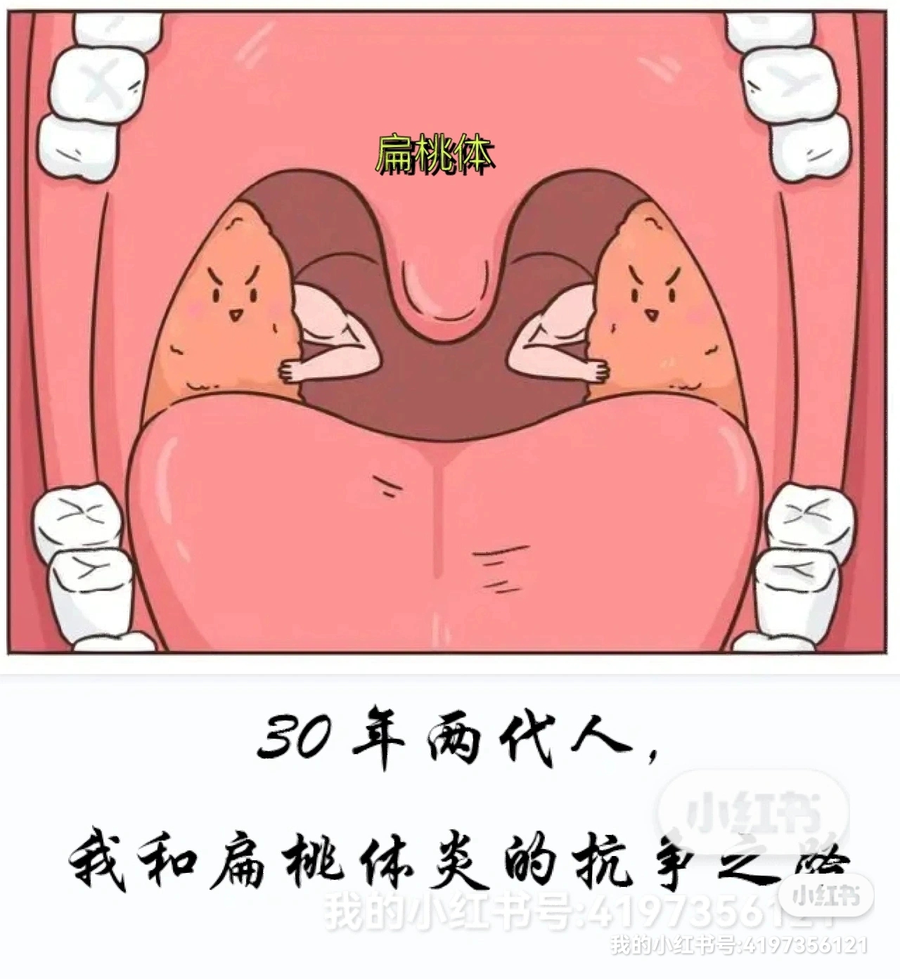 扁桃体发炎对比照片图片