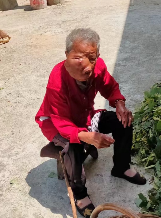 希望帮帮这个"面目狰狞"的人