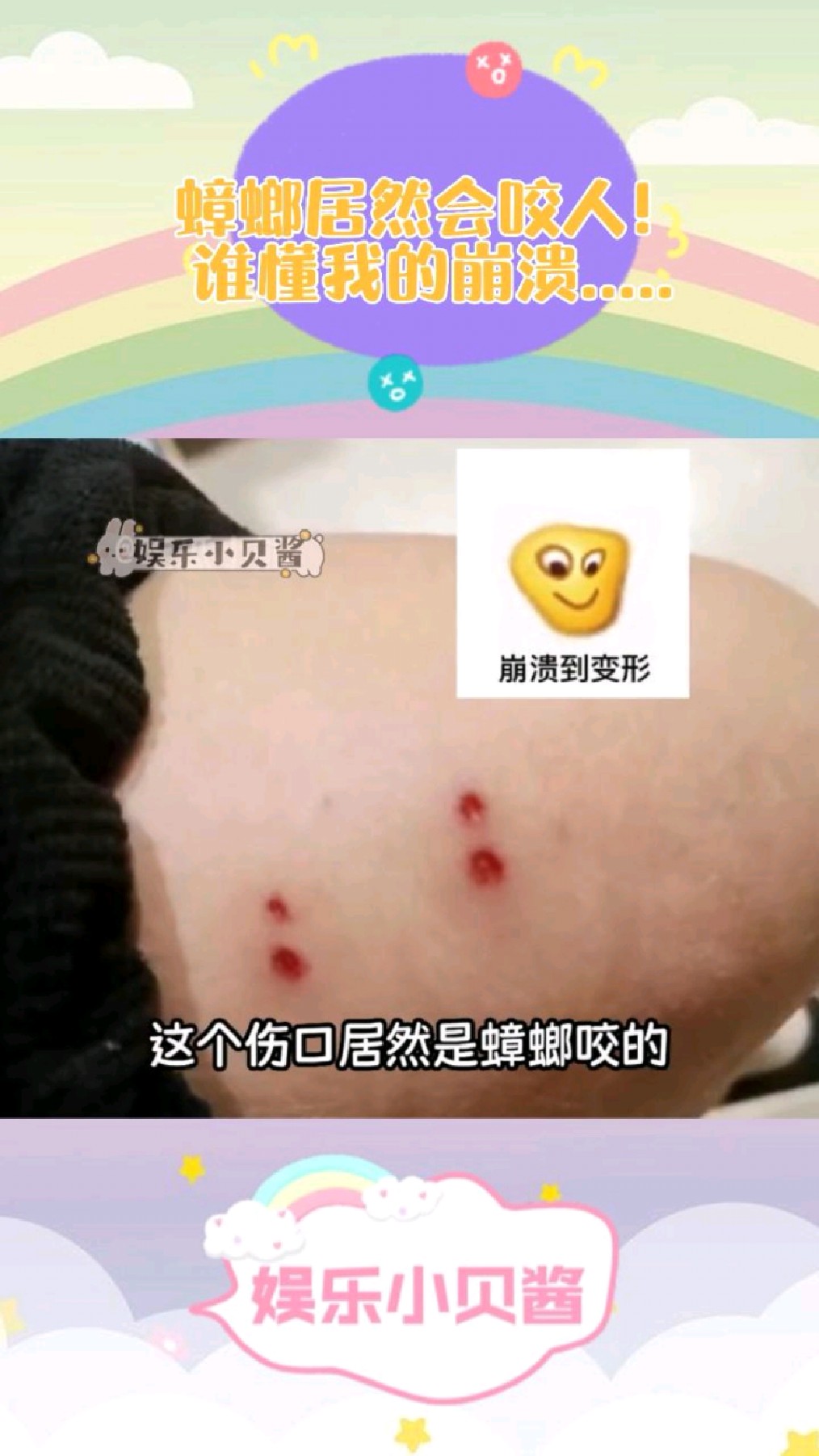 蟑螂居然会咬人!谁懂我的崩溃.