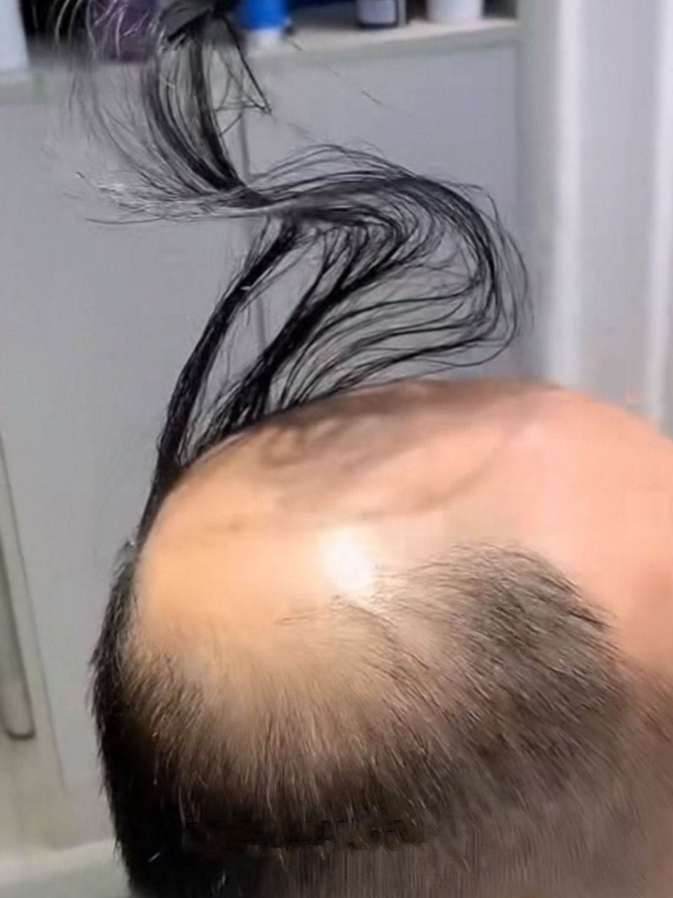 头发都这样了,请问中年男性:你还有什么好倔强的?