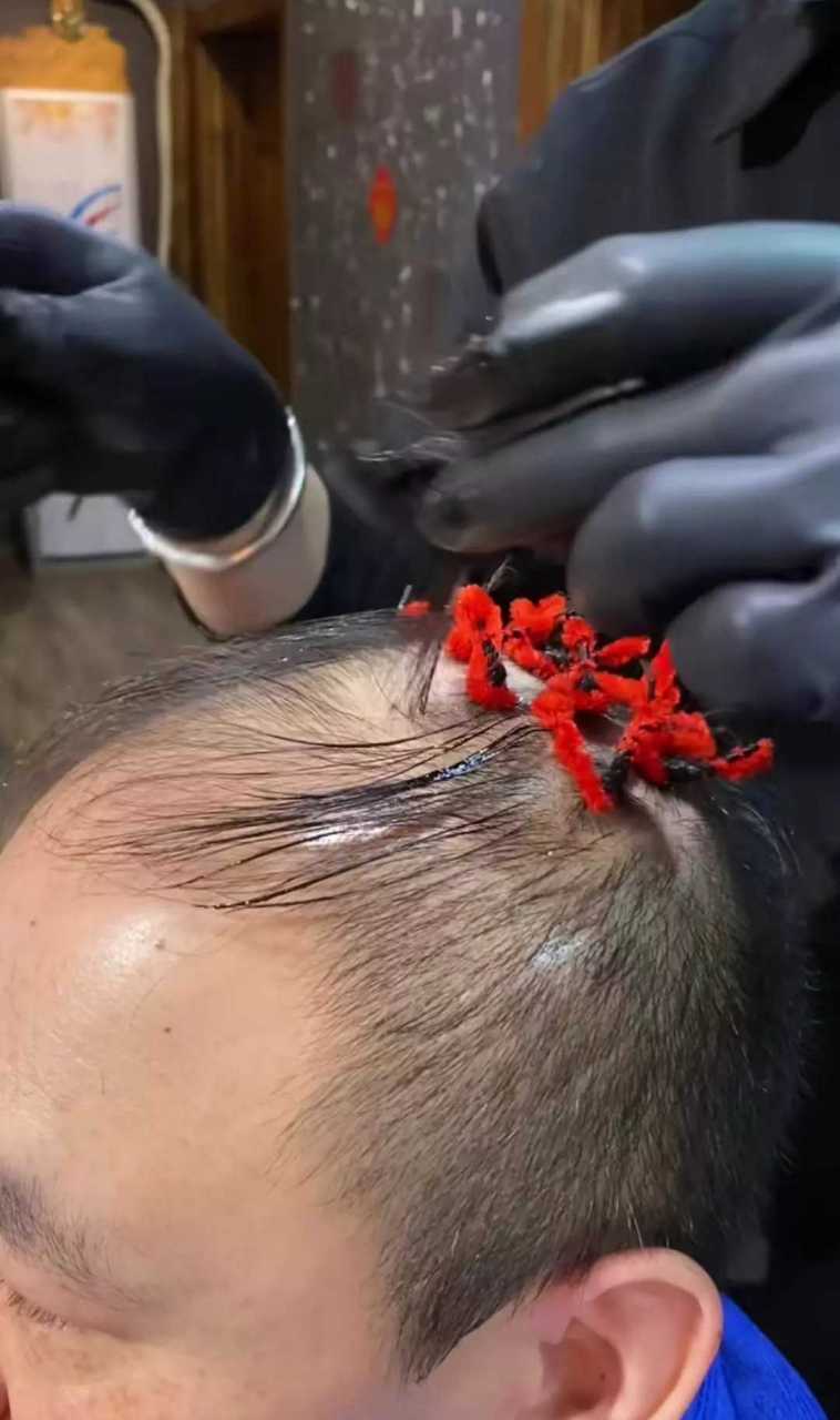 大哥就这几根头发也不放过,最后的倔强啊!