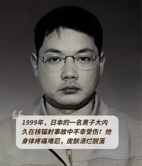日本男子遭受核辐射,被医生强行续命83天 日本男子被医生强行续命83天