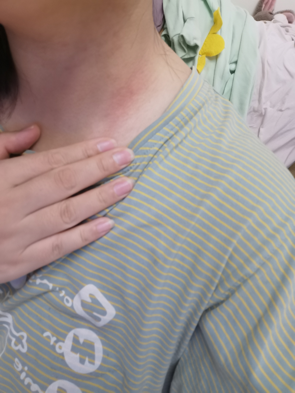 到底是什么奇怪体质啊,那么容易过敏,不说别的,就连戴个项链都能过敏