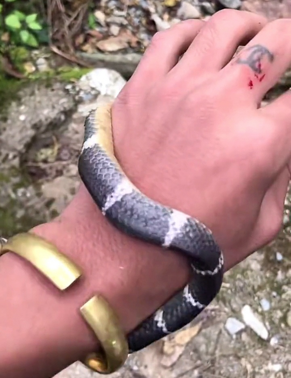 被这条蛇咬了一口,不知道有没有毒呀?