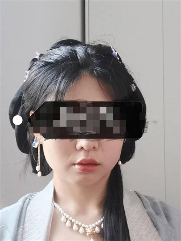 瘦脸针一针解决!
