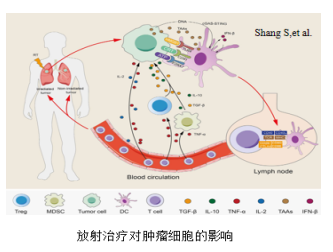 肺癌免疫治疗联合放射治疗
