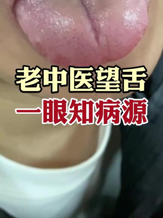 老中医望舌,一眼知病源!