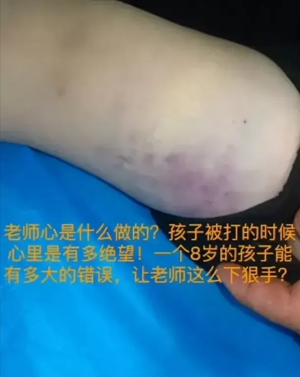 被武术教练打死的青岛8岁男孩的尸检报告出来了,"钝器多次击打,导致的