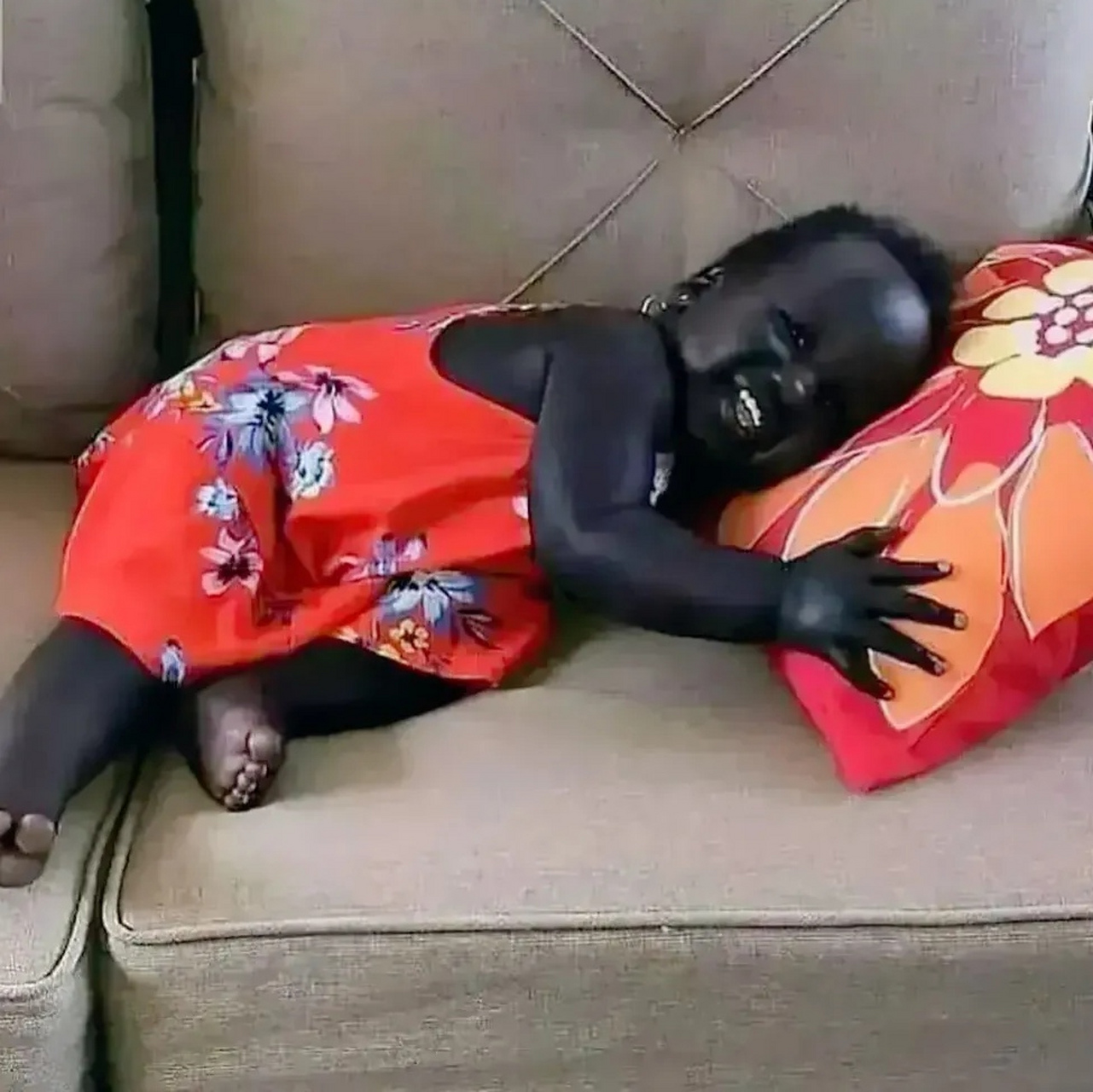 邻居家的媳妇生了个黑色的大胖小子,娃娃全身的皮肤