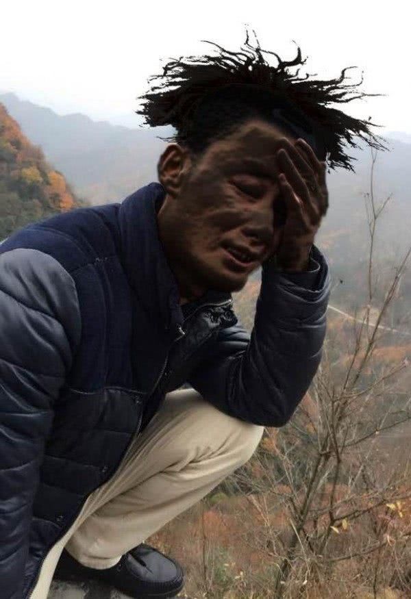 科学证实:男人比女人更容易遭雷劈