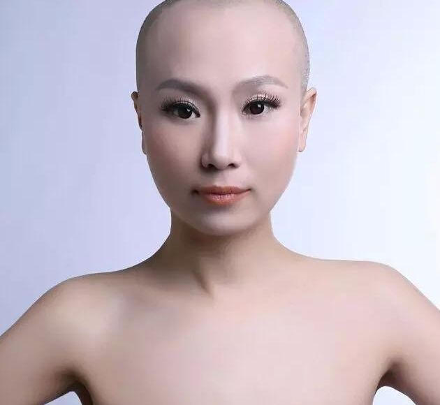 天生光头戴了20多年的假发,取下假发后,惊艳全场