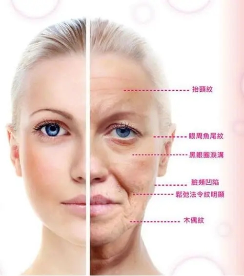 面部提升 面部老化体征的表现