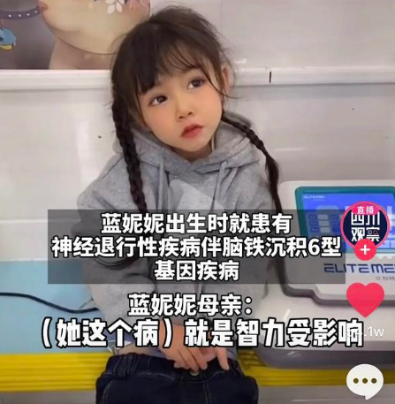 蓝妮妮:绝世容颜却患罕见的基因病,医生诊断会慢慢退化成植物人
