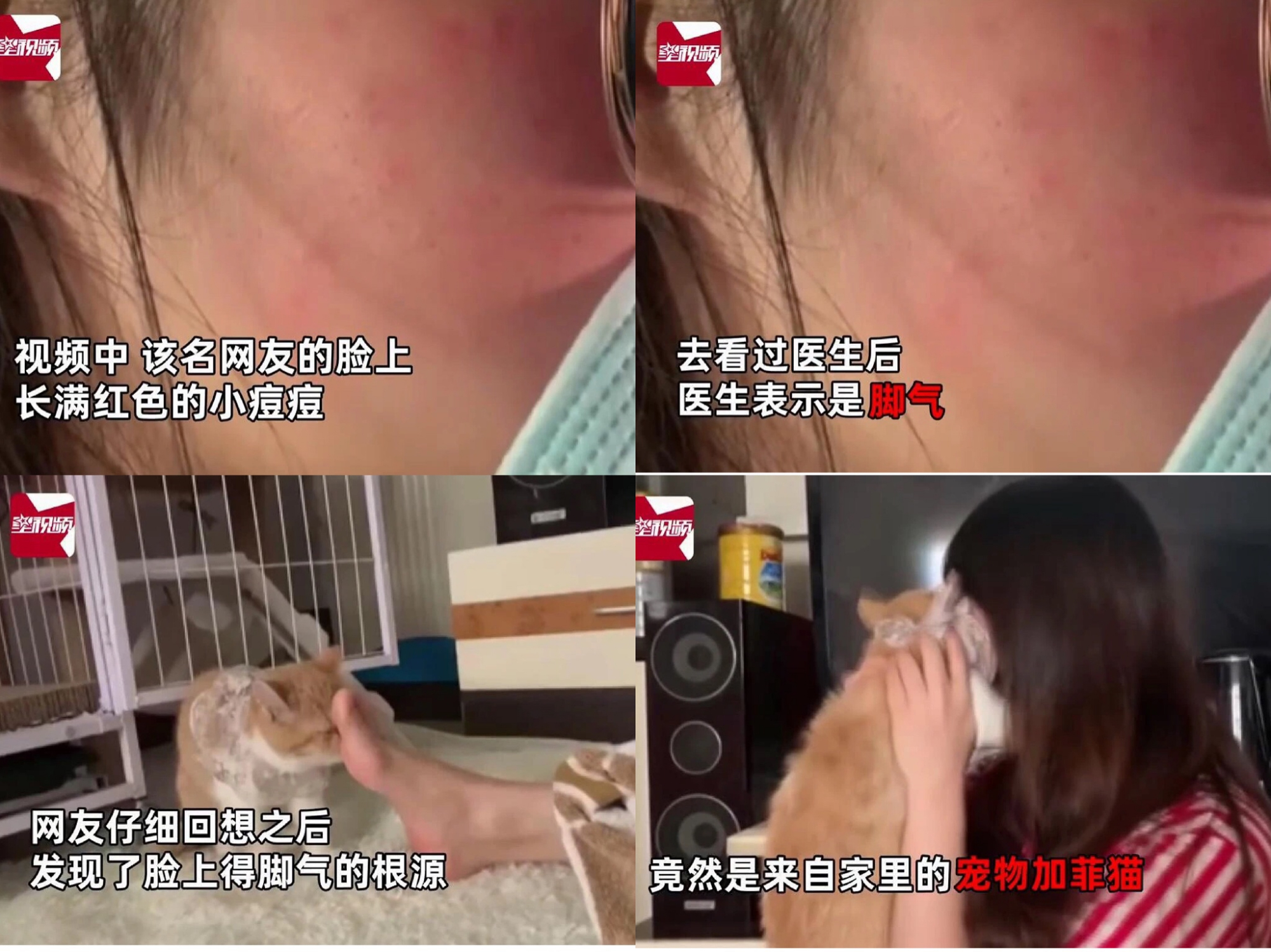 脸上得了脚气?没想到竟然是因为家里的猫!