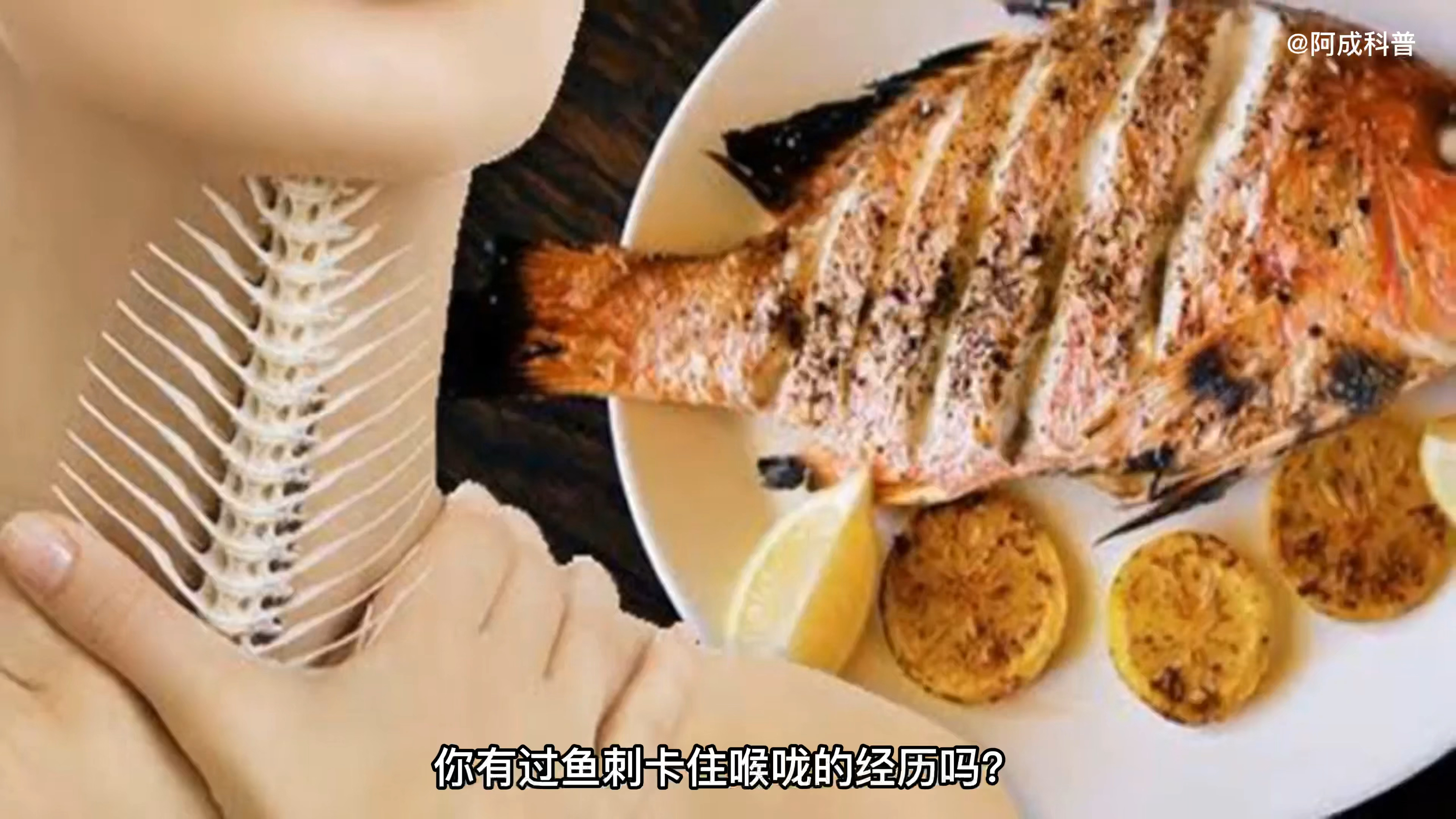 鱼刺卡喉该怎么办?很多人都做错了