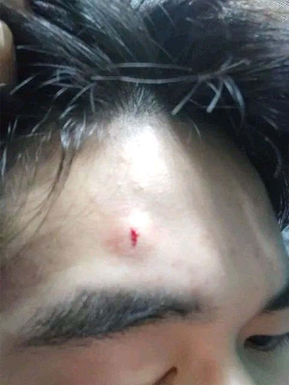 湖北武汉一名张同学在睡觉时无意识拽到充电器,结果