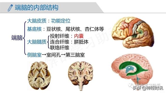 端脑