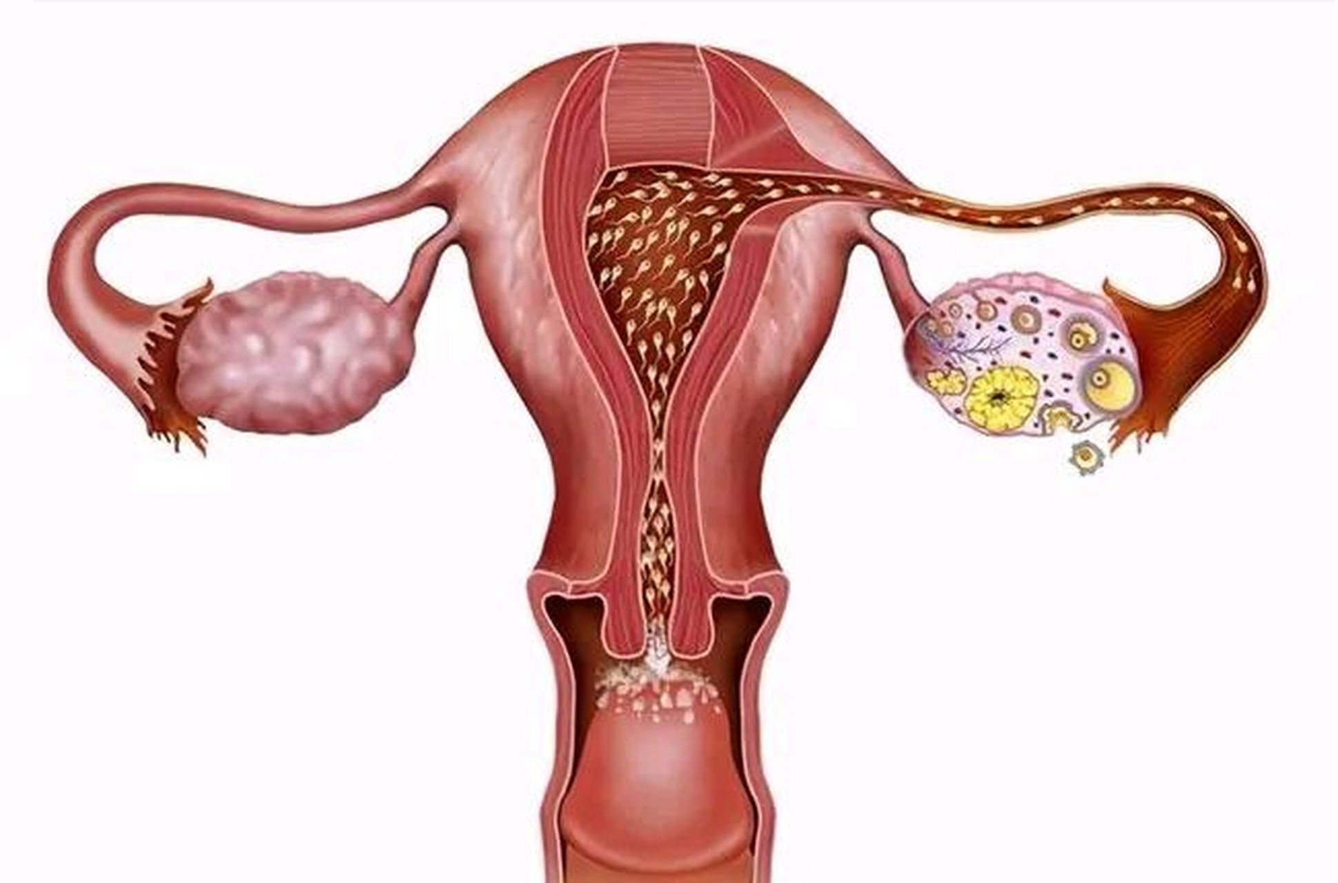 28岁女子检查发现卵巢已40岁#