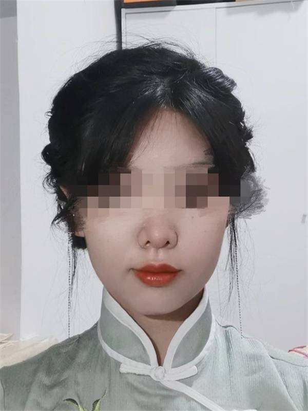 瘦脸针一针解决!