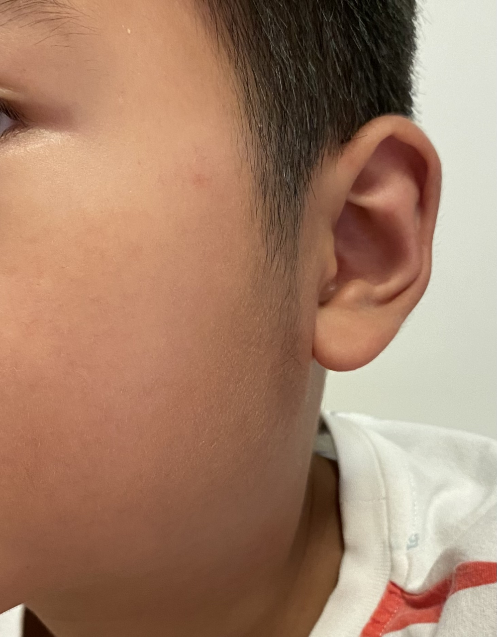 其实,孩子的腮部肿痛不