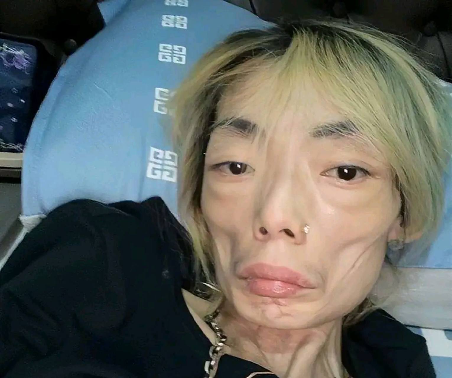 她严重失眠,脸色变得难看,像外星人一样苍白憔悴.