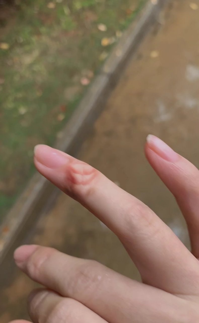 看了那么多腹肌,手指也长出了腹肌,向别人竖无名指也有底气了9999