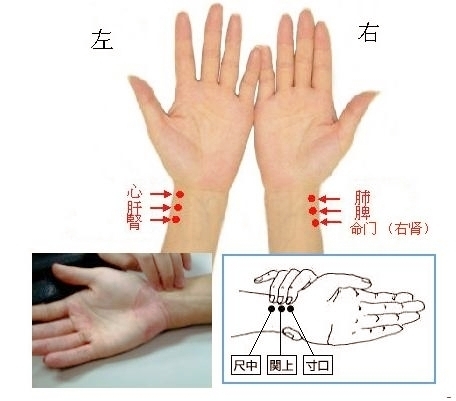 反关脉 斜飞脉图片