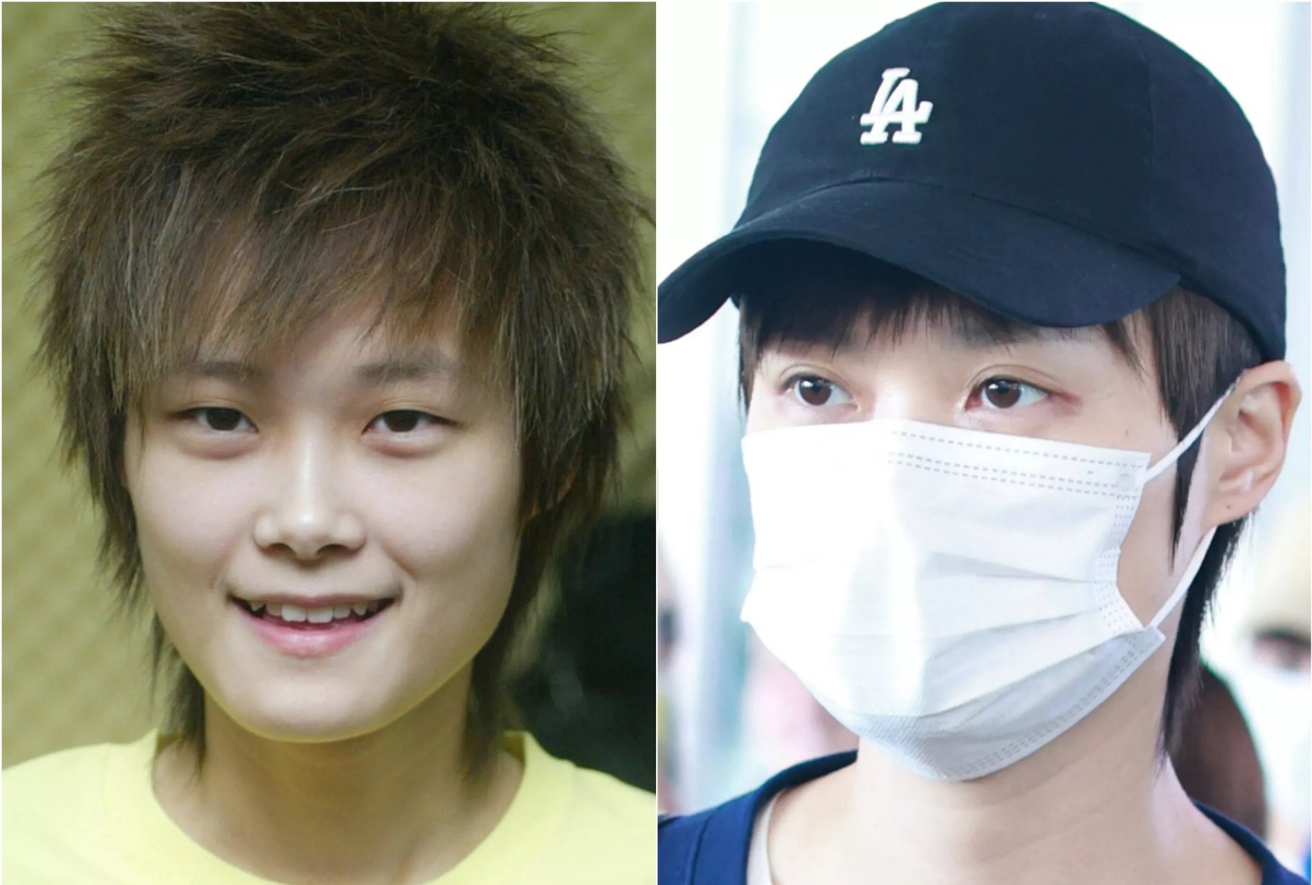 在娱乐圈里,演艺明星的外貌变化一直备受瞩目,而最近李宇春的一次整容