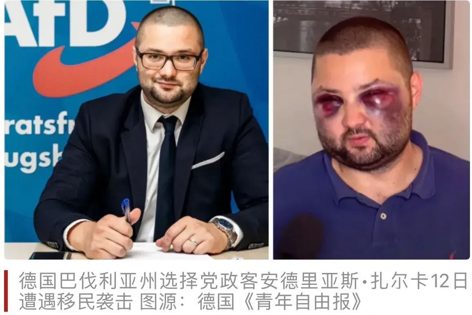 太不地道了,下手太狠就算了,还专门打眼睛,感觉就像是被蜜蜂93叮了