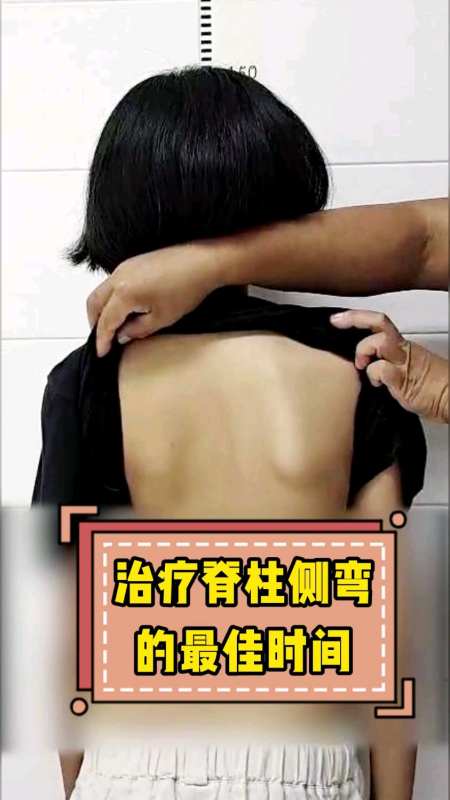 脊柱侧弯最佳治疗时间是什么时候什么是生长爆发期