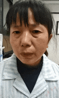 左眼跳财,右眼跳灾是真的吗?专家提醒:小心延误病情