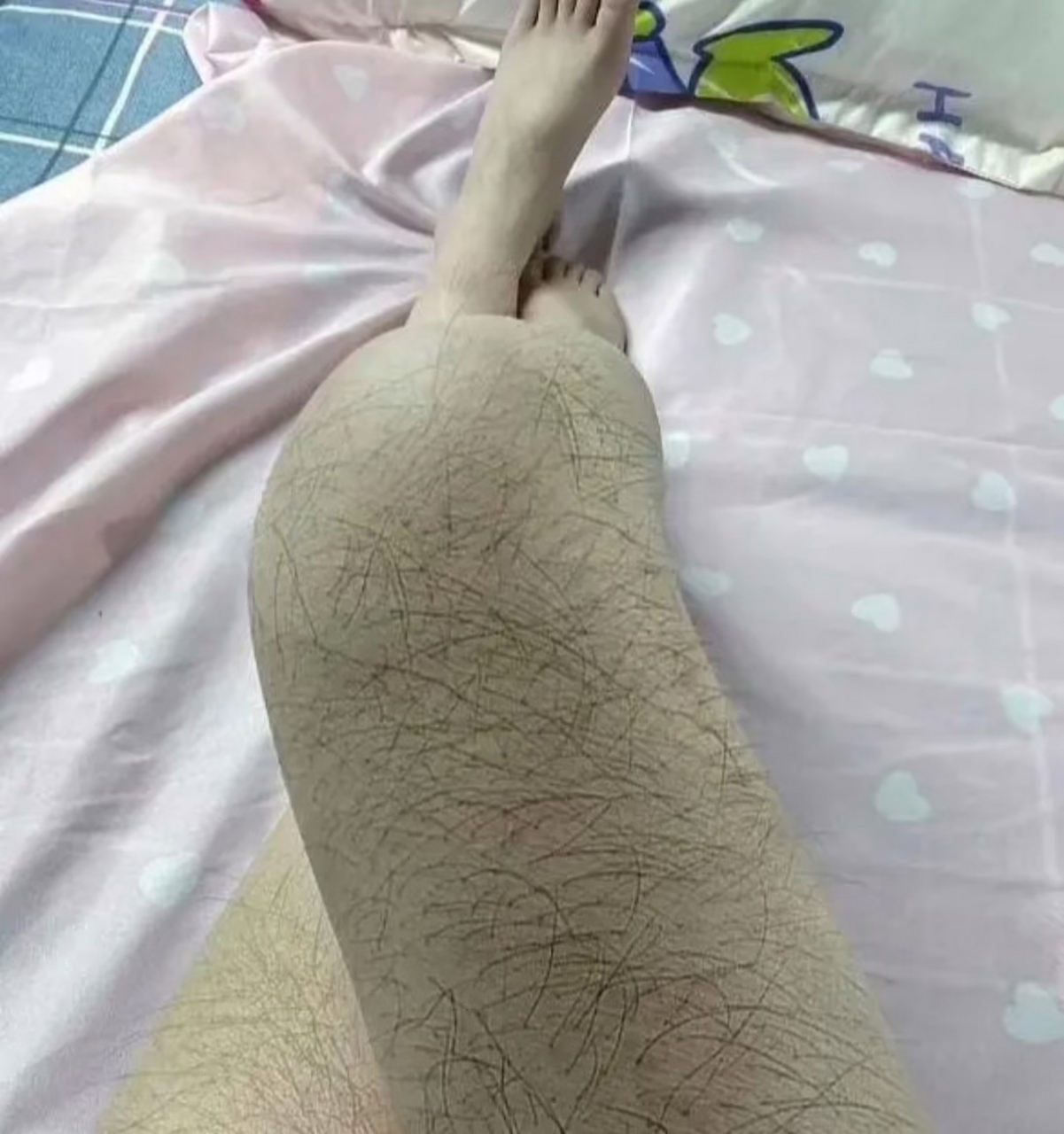 女朋友这个腿毛长的还是很快的,用什么袪毛效果比较好?