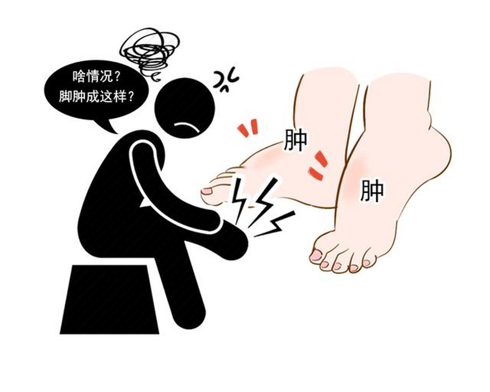 肿瘤癌症患者在化疗后以及术后,经常会出现上肢或者下肢水肿的情况