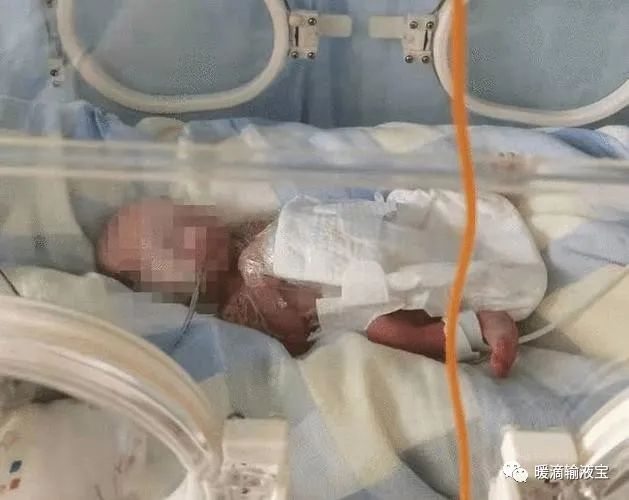 早产儿输液加温防止低体温,减少感染率,给宝宝一个温暖的环境