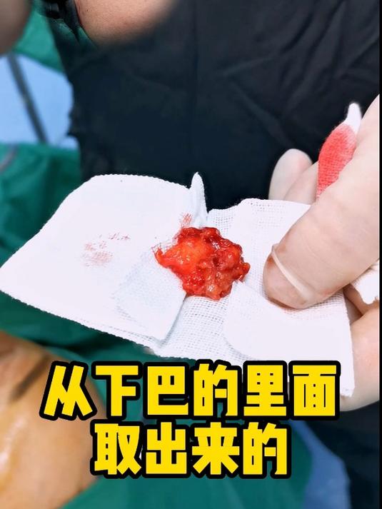 黎星生长因子修复实例真实