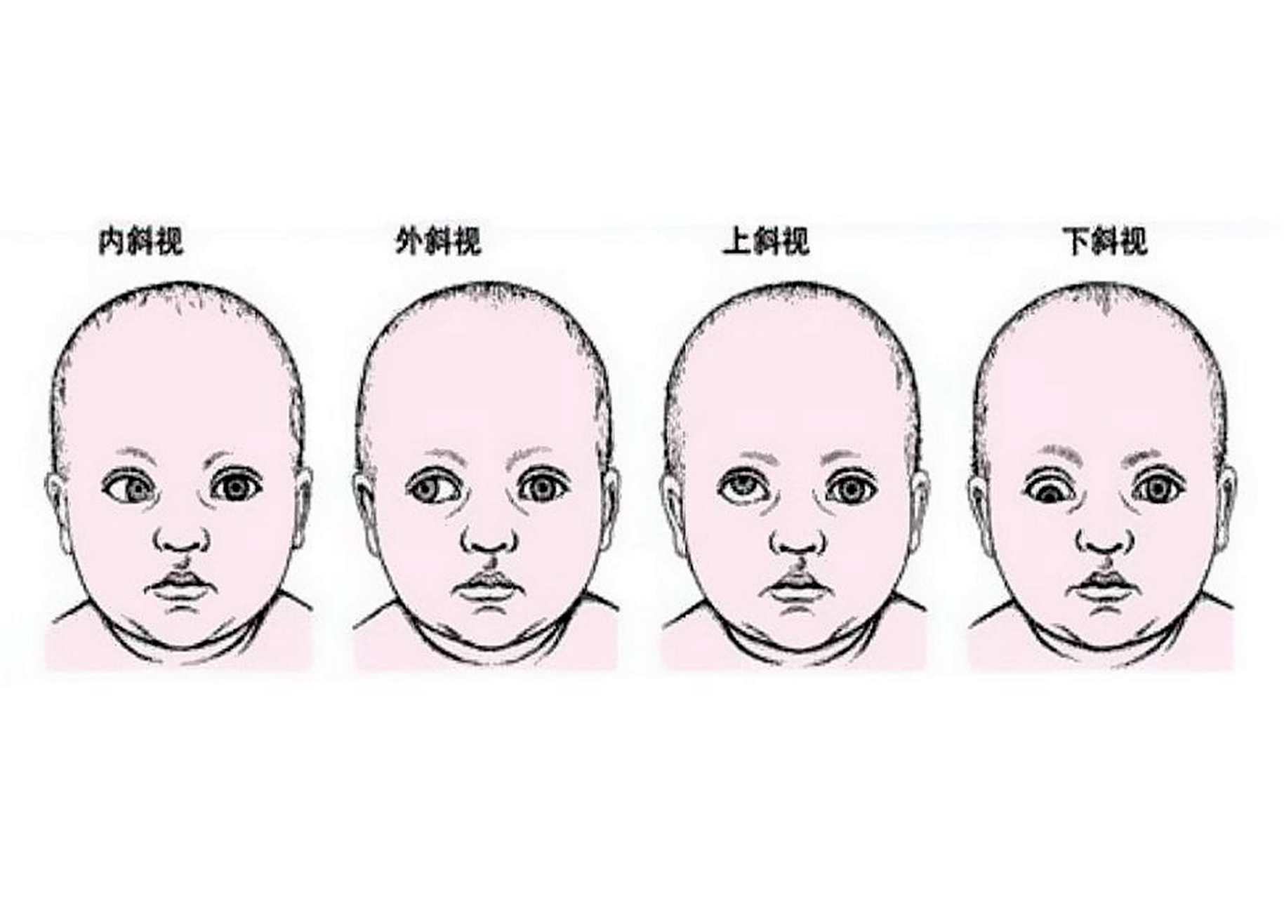 识别宝宝对眼的图片图片