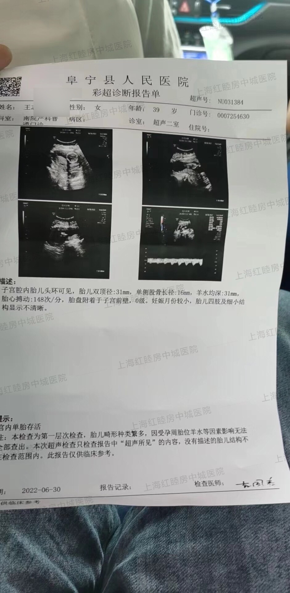 39歲高齡懷孕不容易,上海紅睦房中城醫院恭喜王女士