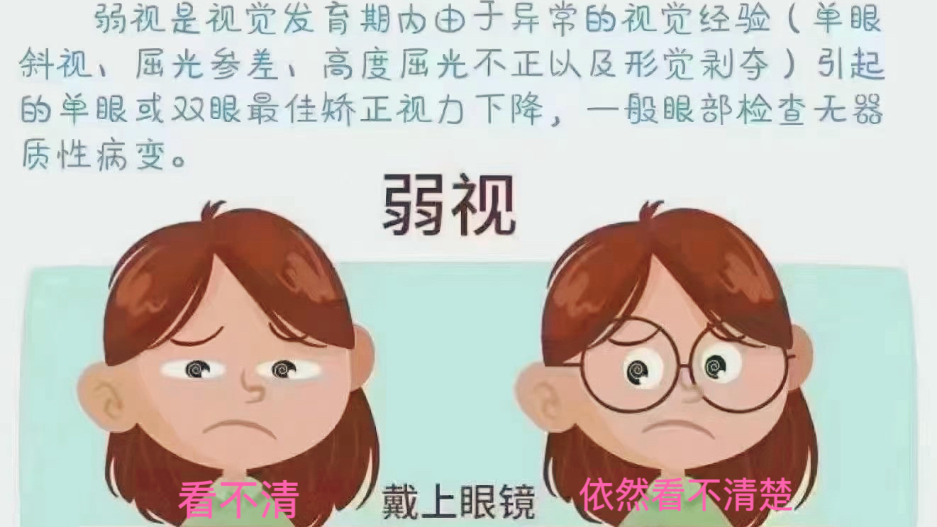 弱视久治不愈的原因