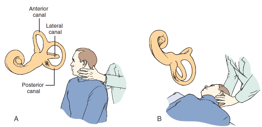 耳石症到底是怎么回事?