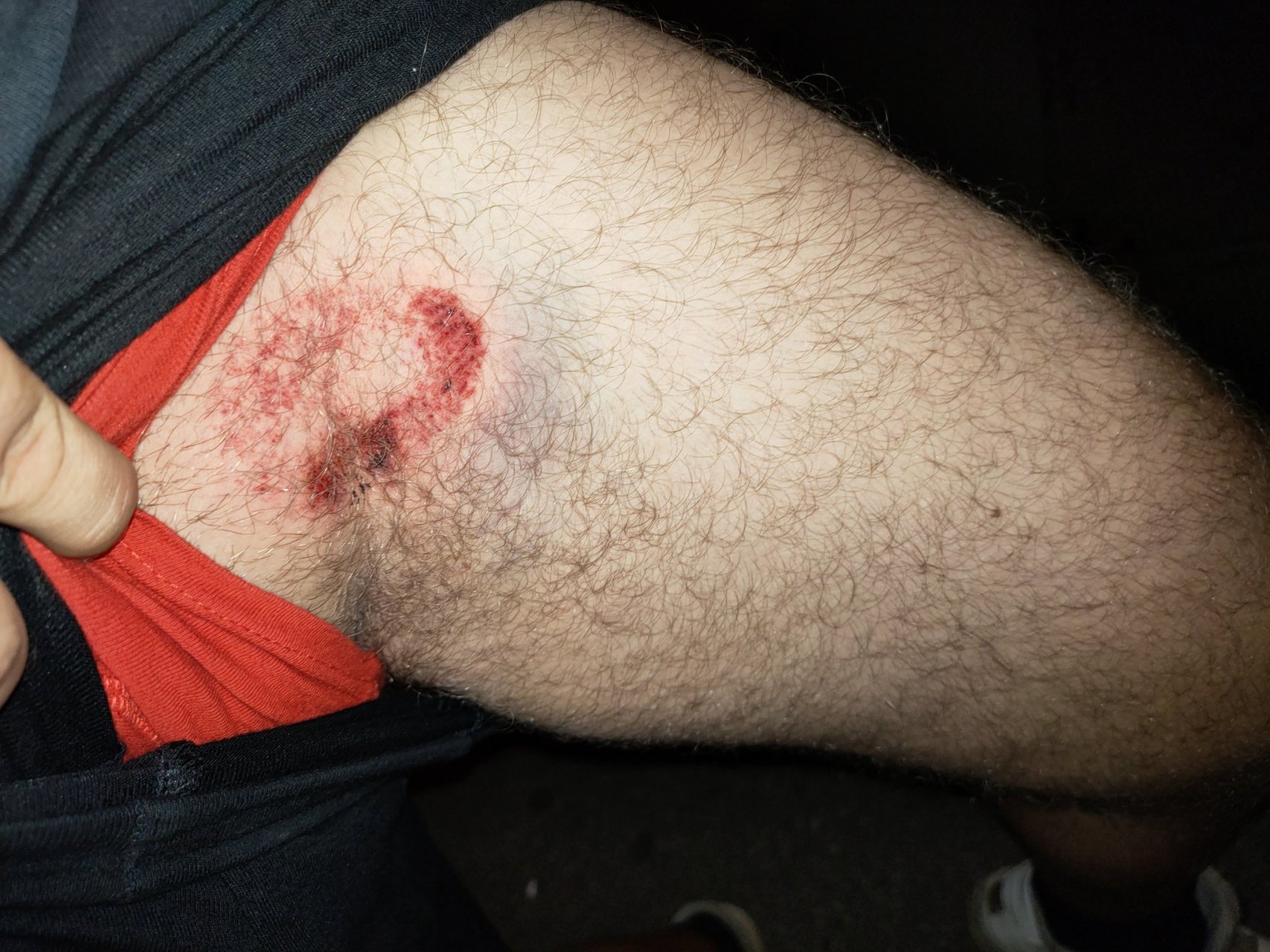 法国军警用于驱散扰乱人群的豆袋弹,使用霰弹枪发射,装药和动能与普通