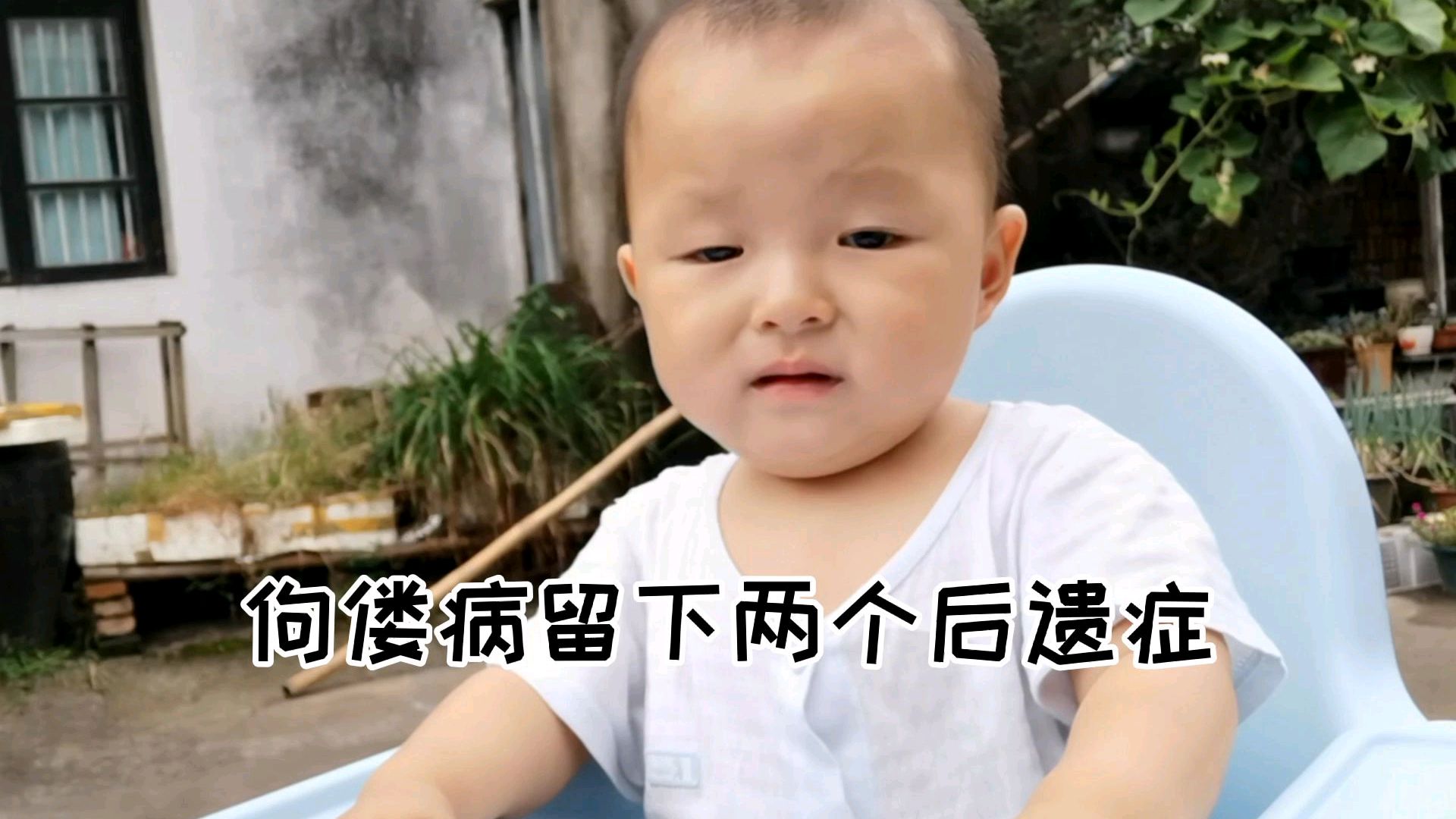 佝偻病留下两个后遗症,一个是罗圈腿,一个是鸡胸