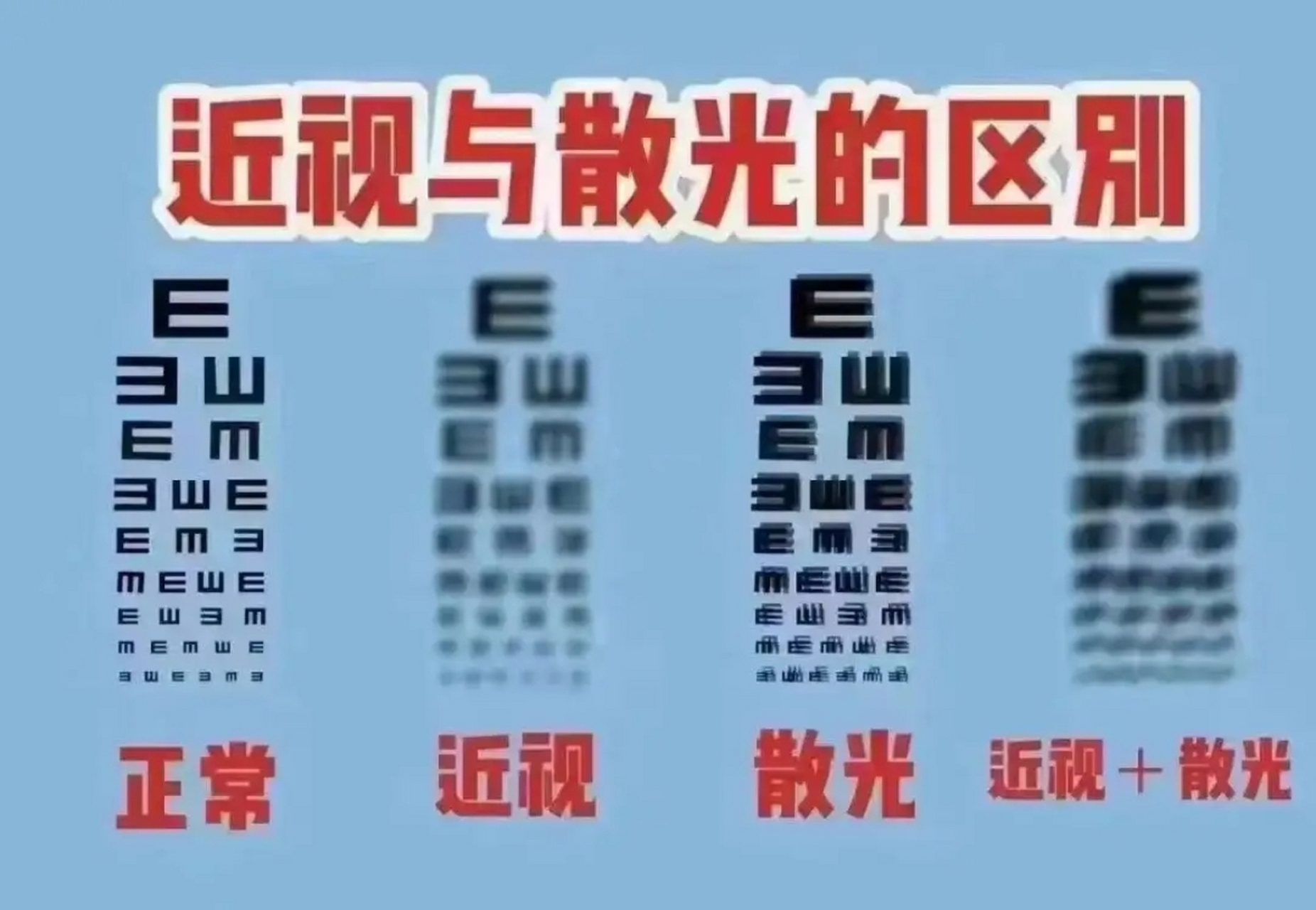 散光成人孩子都可能发生.