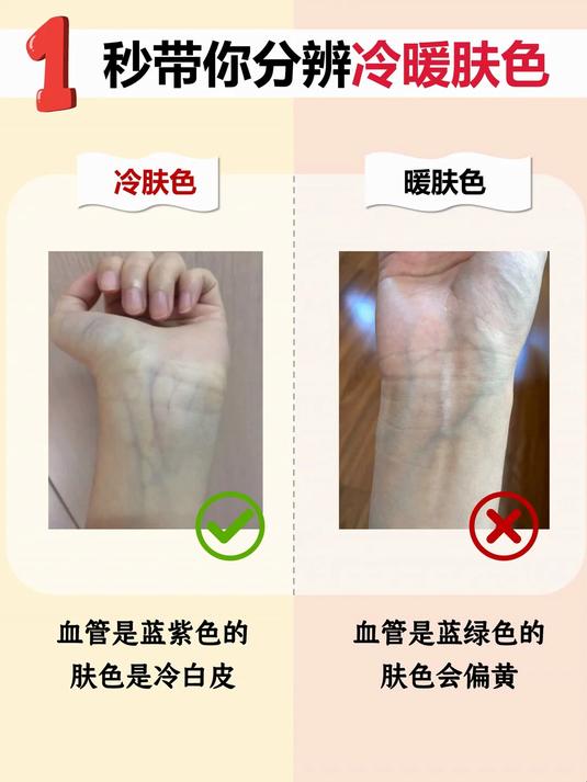 血管是蓝紫色的肤色是冷白皮 血管是蓝绿色的肤色会偏黄