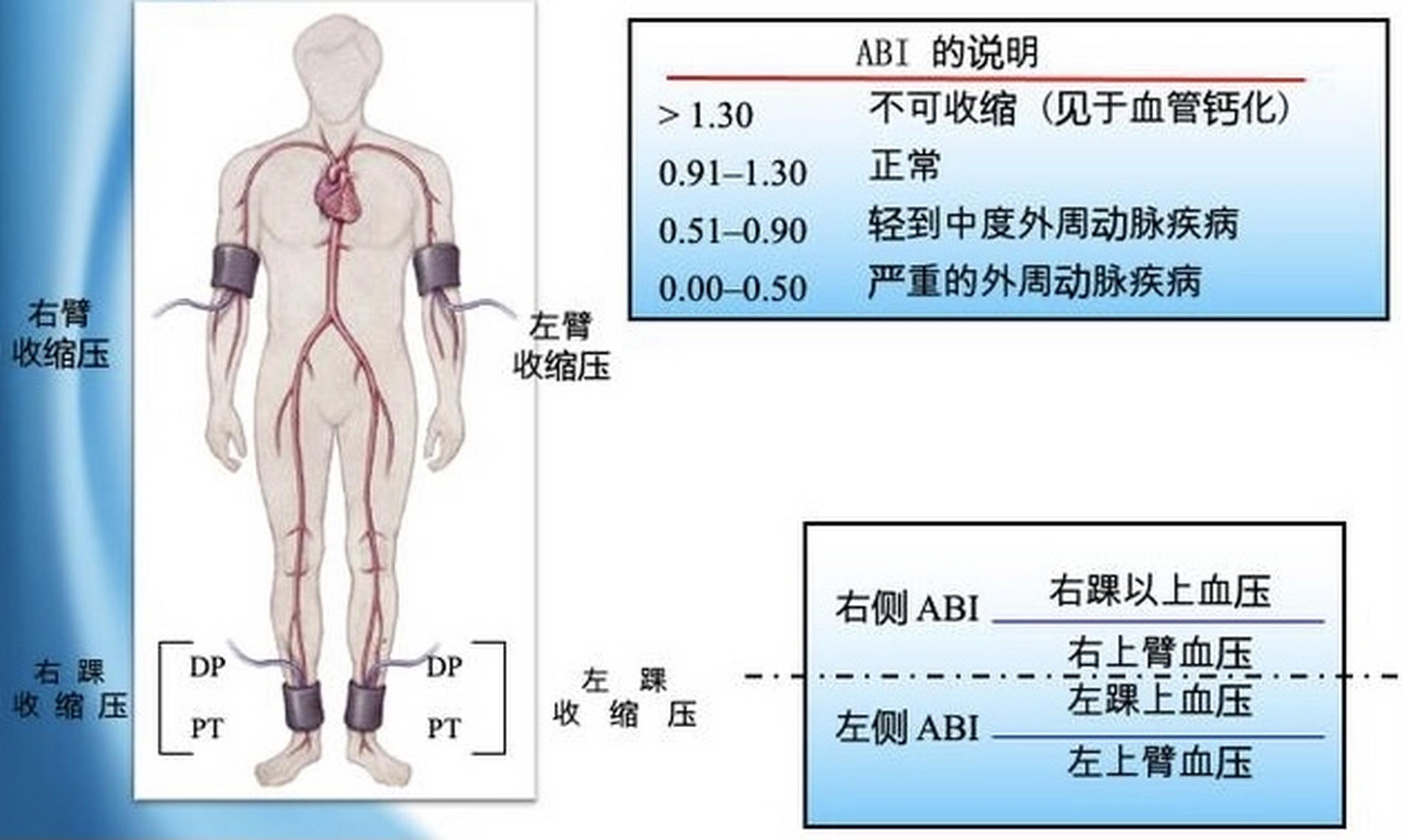 踝肱指数图片