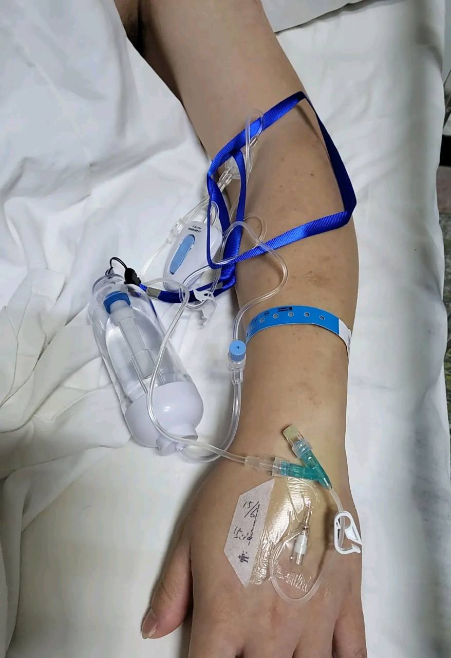 当年我生孩子的时候,我说想用镇痛泵,我老公死活不同意,非说也没多疼