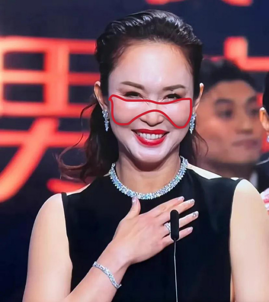 小龙女是本身颧骨过高还是苹果肌得的过度饱满了,笑起来好不自然.