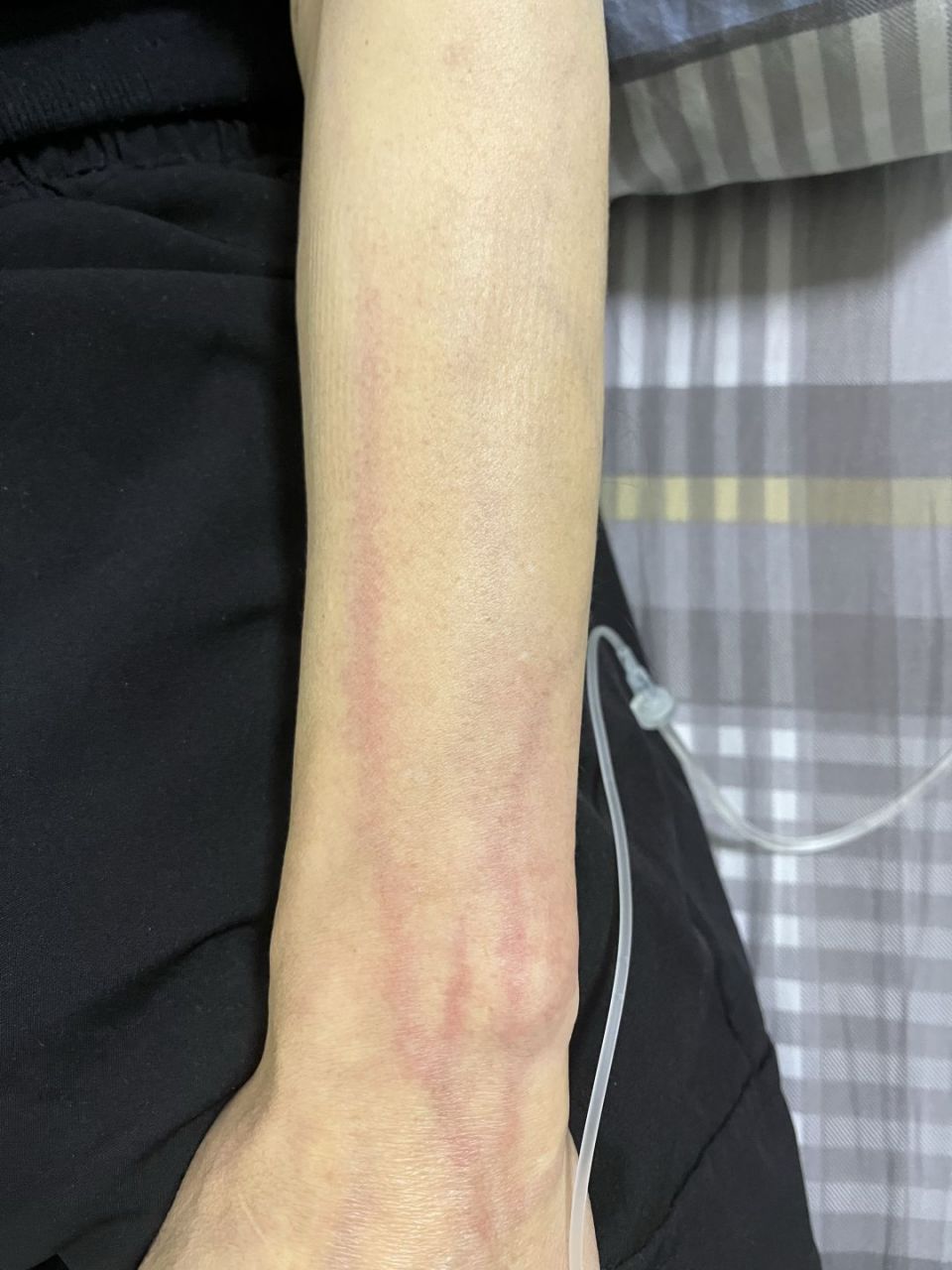 输液成这样,是不是有问题,在线求